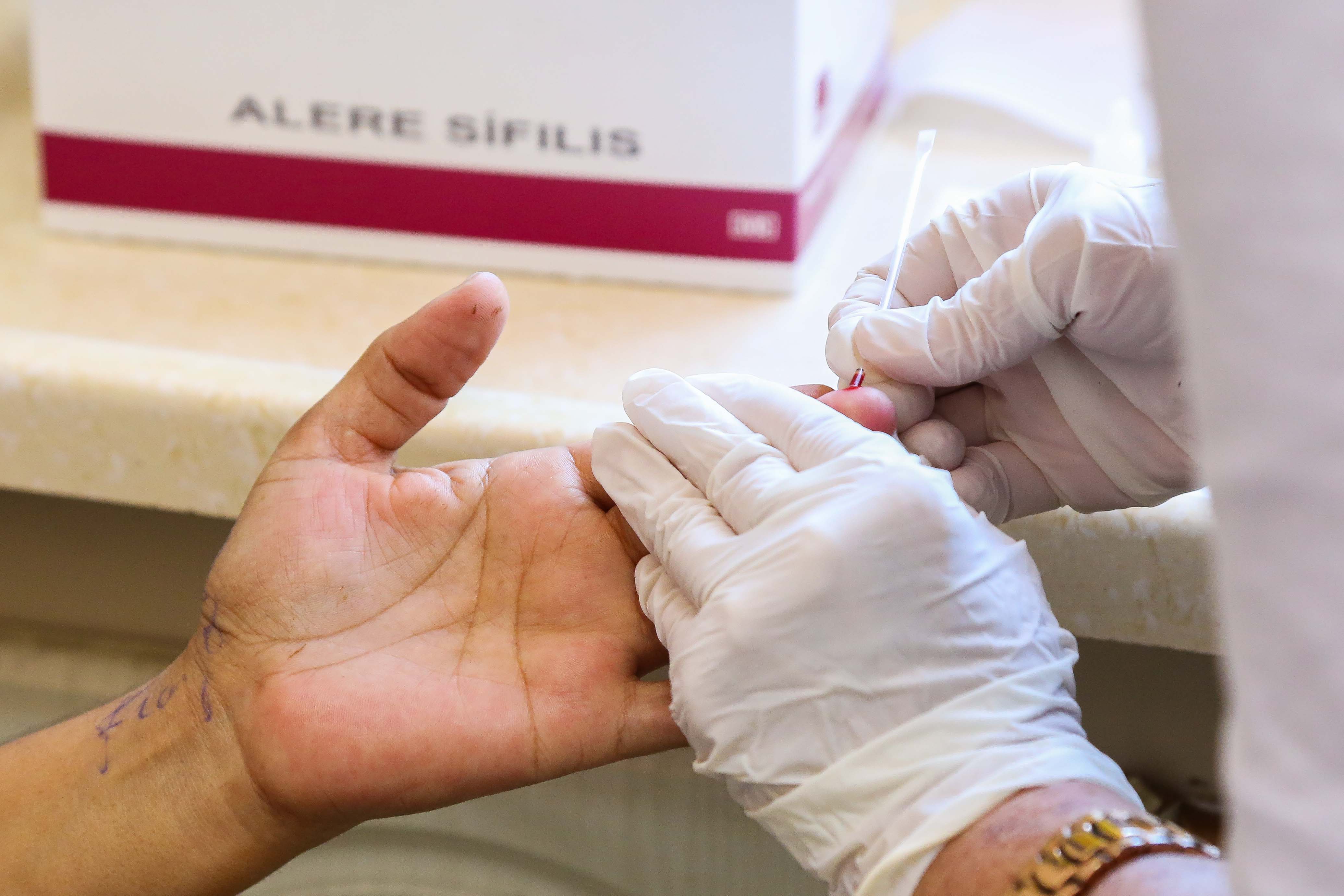 Prefeitura realiza testagem rápida para detecção de HIV e ISTs